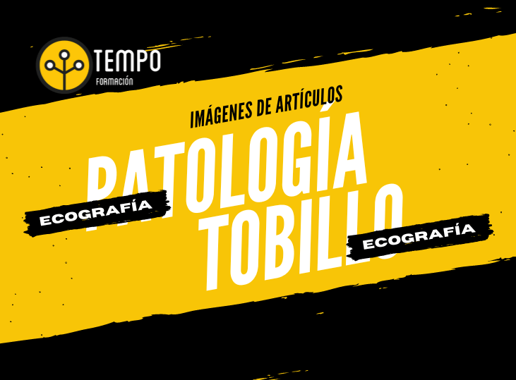 ecografia-y-patologia-del-tobillo-y-pie